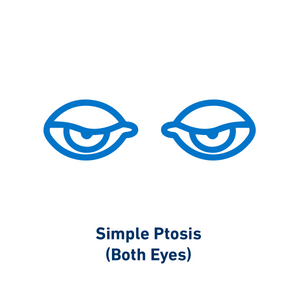 Simple Ptosis (Both Eyes)